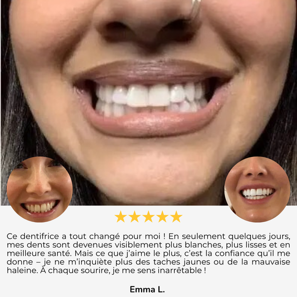 Radiance™ Dentifrice aux Probiotiques